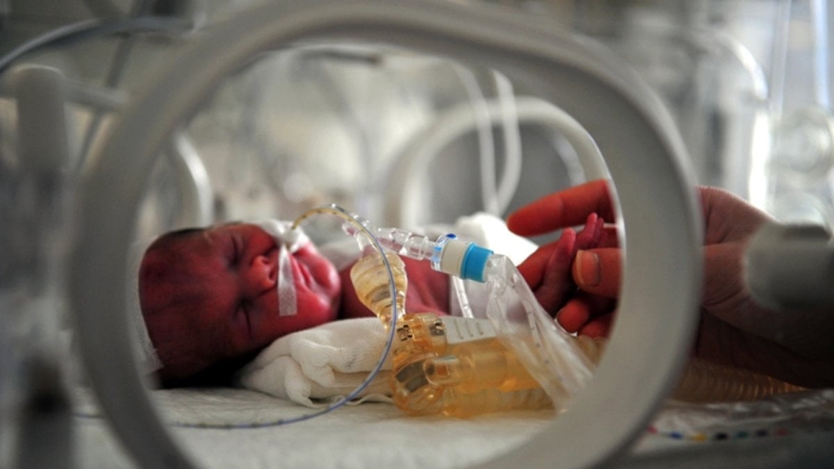 İstanbul'da 17 günlük bebek kuvözde yandı: 4 sağlık çalışanına soruşturma izni