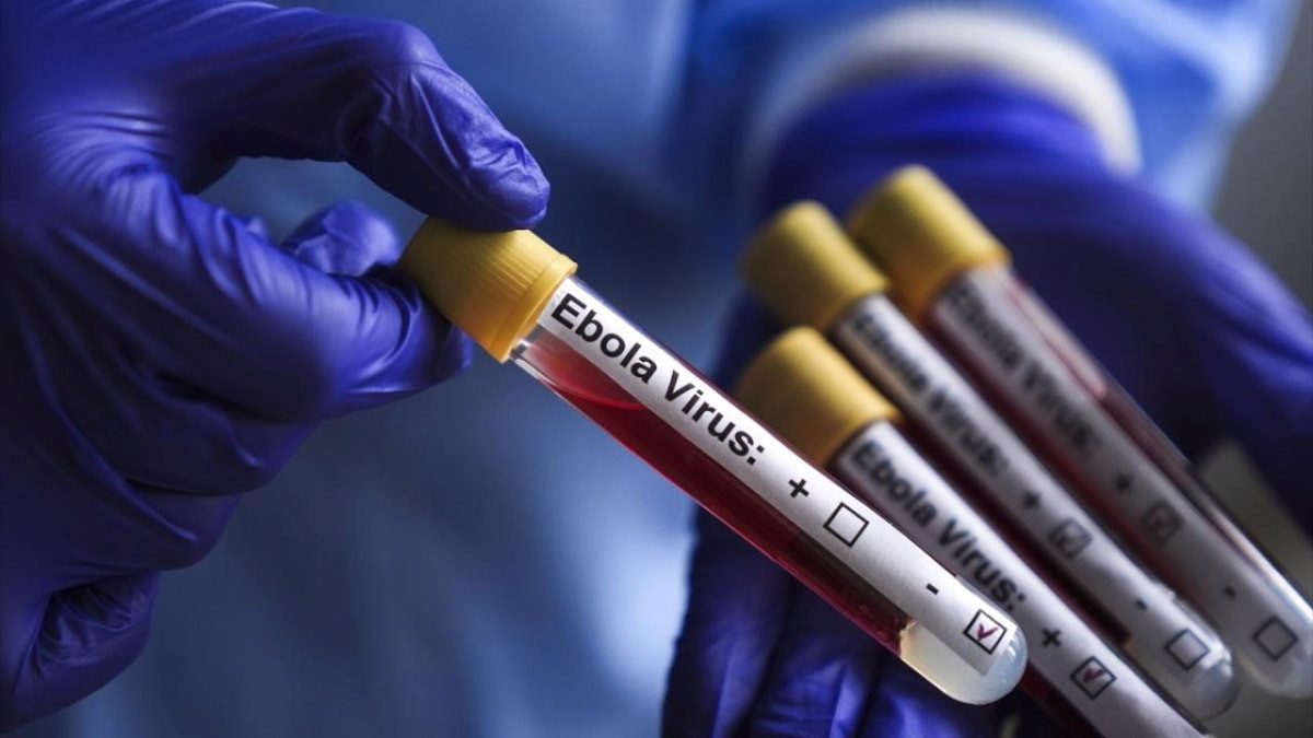 DSÖ: KDC'de Ebola salgınına ilişkin 5 bin 794 vaka ile 2 bin 786 ölüm bildirildi