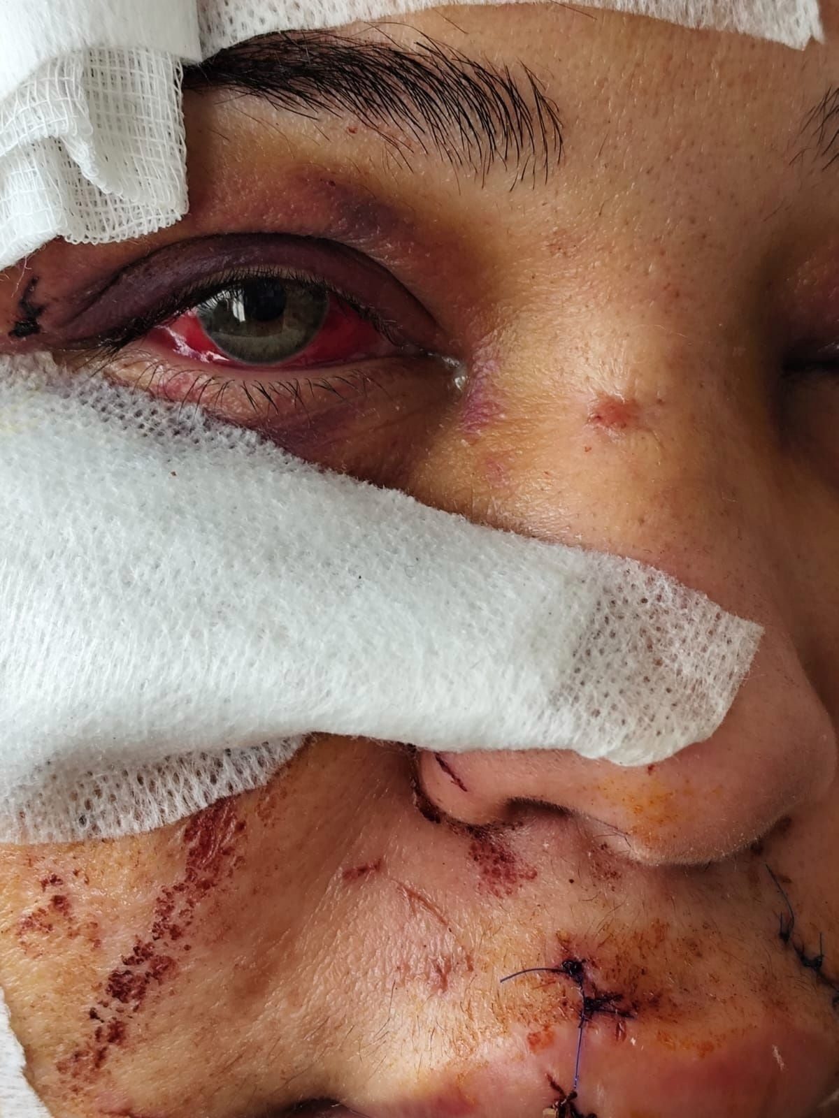 Polis memuru eşini yaraladı: Haksız tahrik ve iyi hal indirimiyle tahliye
