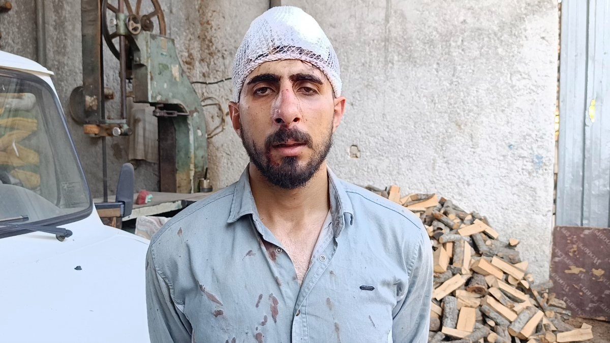 Şanlıurfa'da trafikte 'yavaş gittin' dayağı: Burnu kırıldı, başına 8 dikiş atıldı